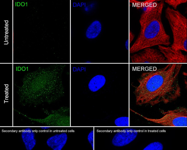 IDO Antibody in Immunocytochemistry (ICC/IF)