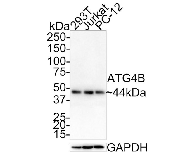 ATG4B Antibody in Western Blot (WB)