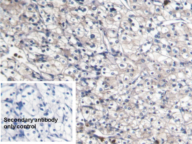 S100A8 Antibody in Immunohistochemistry (Paraffin) (IHC (P))
