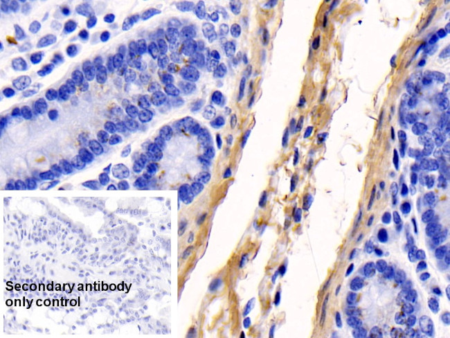 COL1A1 Antibody in Immunohistochemistry (Paraffin) (IHC (P))
