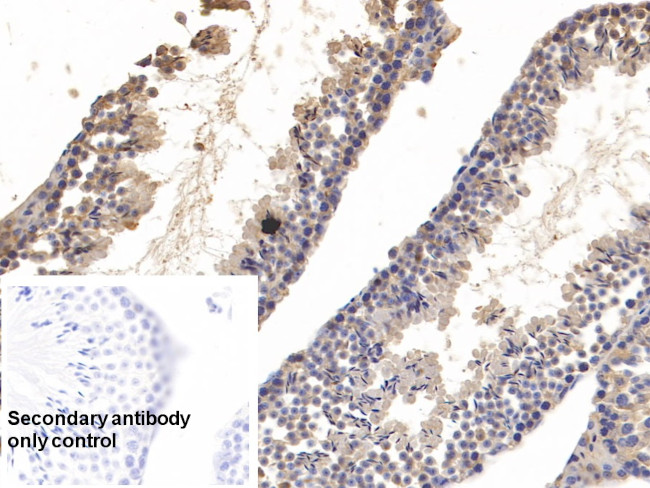 Cyclophilin A Antibody in Immunohistochemistry (Paraffin) (IHC (P))
