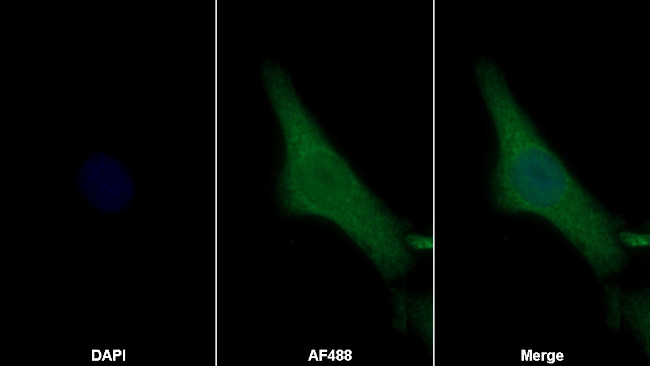 Periostin Antibody in Immunocytochemistry (ICC/IF)