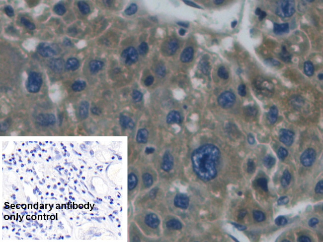Haptoglobin Antibody in Immunohistochemistry (Paraffin) (IHC (P))