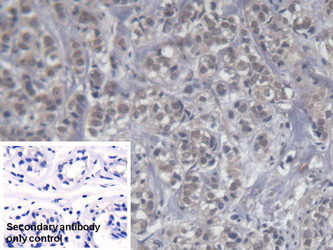 KIR2DS4 Antibody in Immunohistochemistry (Paraffin) (IHC (P))