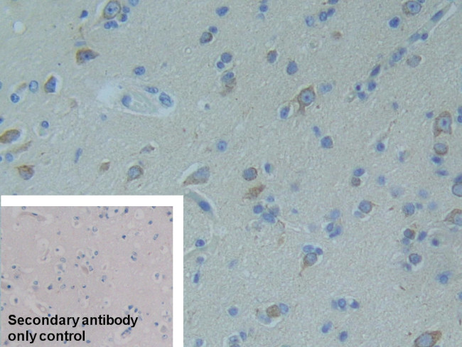 Complement Factor H Antibody in Immunohistochemistry (Paraffin) (IHC (P))