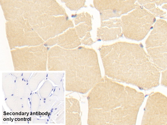 GPT Antibody in Immunohistochemistry (Paraffin) (IHC (P))