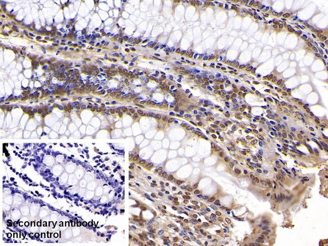 KPNA2 Antibody in Immunohistochemistry (Paraffin) (IHC (P))