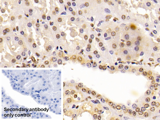 ENO1 Antibody in Immunohistochemistry (Paraffin) (IHC (P))
