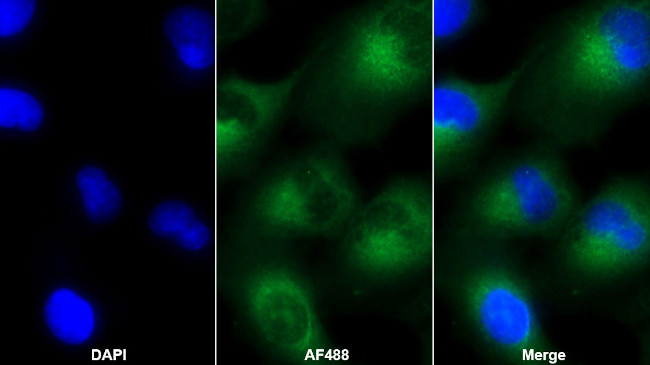 IGFBP-1 Antibody in Immunocytochemistry (ICC/IF)