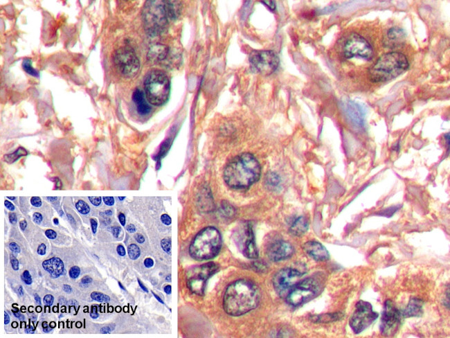 SERPINB3 Antibody in Immunohistochemistry (Paraffin) (IHC (P))
