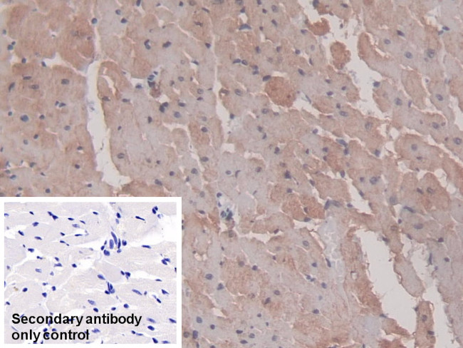 DCLK1 Antibody in Immunohistochemistry (Paraffin) (IHC (P))
