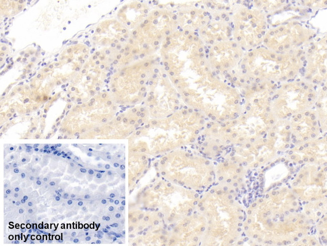 CTRP1 Antibody in Immunohistochemistry (Paraffin) (IHC (P))
