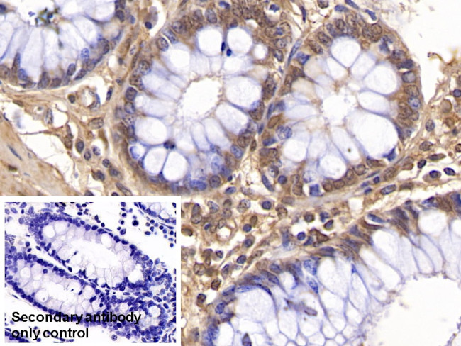 NAMPT Antibody in Immunohistochemistry (Paraffin) (IHC (P))