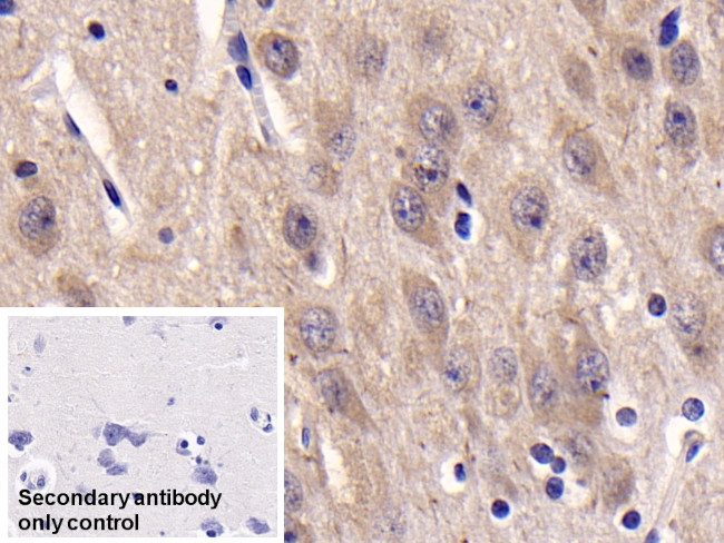 CK1 delta Antibody in Immunohistochemistry (Paraffin) (IHC (P))