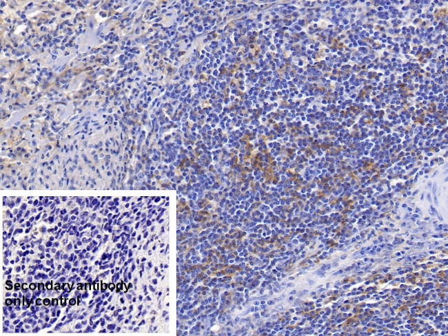 HLA-DRB1 Antibody in Immunohistochemistry (Paraffin) (IHC (P))