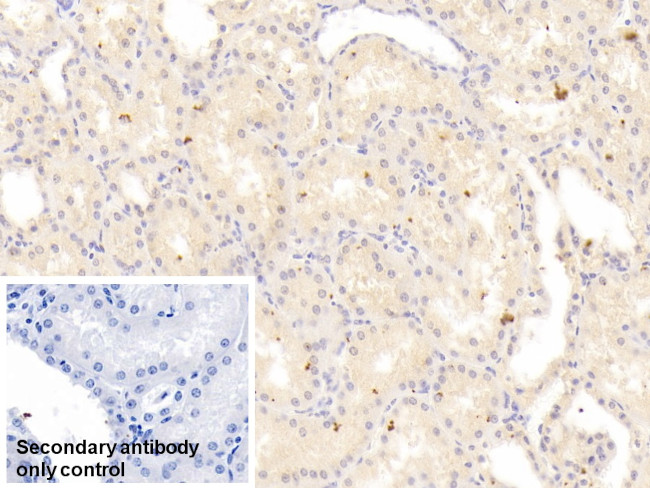 RIP1 Antibody in Immunohistochemistry (Paraffin) (IHC (P))
