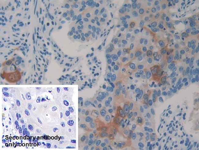 HSP27 Antibody in Immunohistochemistry (Paraffin) (IHC (P))