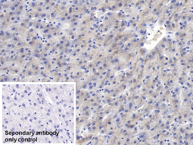 SAA Antibody in Immunohistochemistry (Paraffin) (IHC (P))