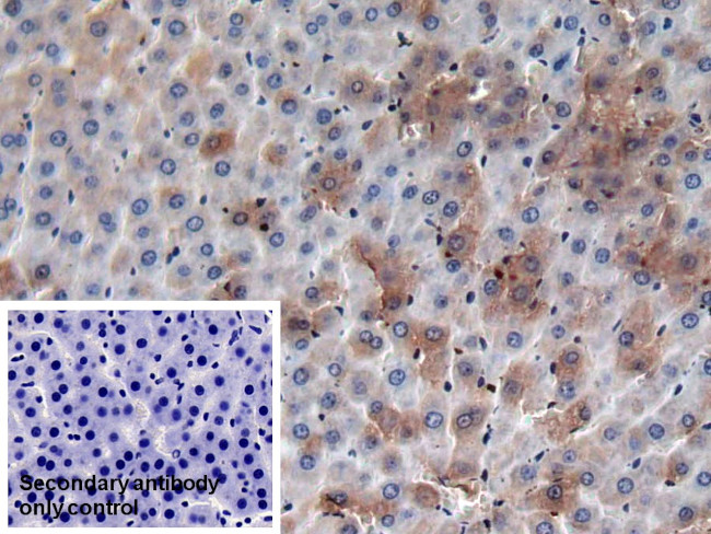 Prothrombin Antibody in Immunohistochemistry (Paraffin) (IHC (P))