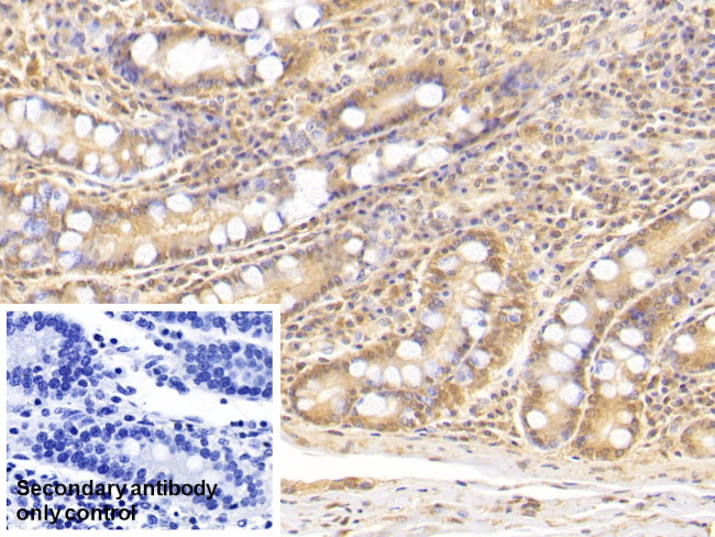 Complement C5a Antibody in Immunohistochemistry (Paraffin) (IHC (P))