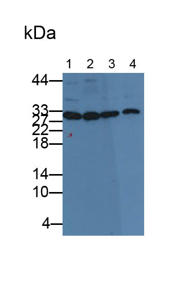 Carbonic Anhydrase III Antibody in Western Blot (WB)