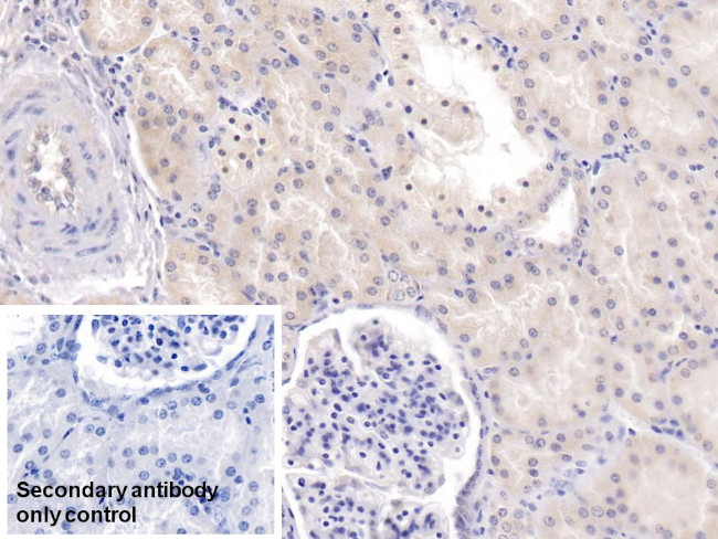 TDO2 Antibody in Immunohistochemistry (Paraffin) (IHC (P))