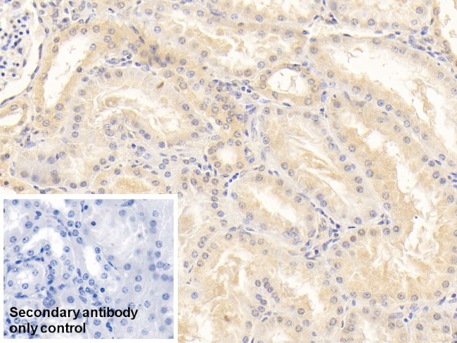 SERPINF2 Antibody in Immunohistochemistry (Paraffin) (IHC (P))