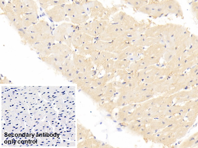 FABP4 Antibody in Immunohistochemistry (Paraffin) (IHC (P))