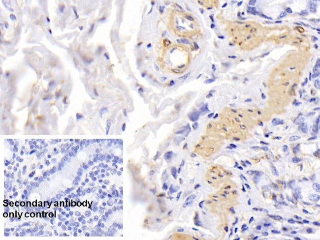 alpha-Cardiac Actin Antibody in Immunohistochemistry (Paraffin) (IHC (P))