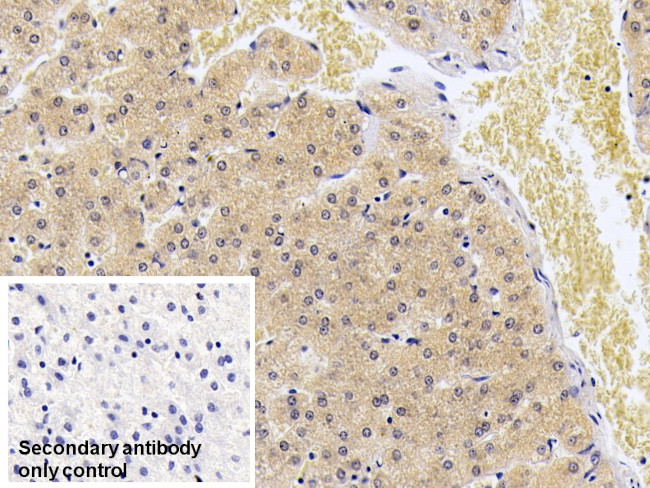 S100A9 Antibody in Immunohistochemistry (Paraffin) (IHC (P))