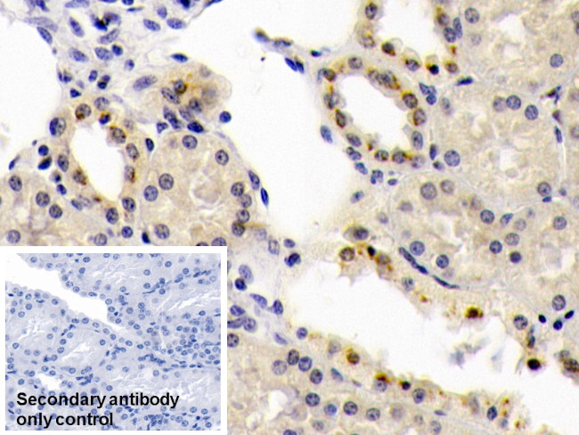BMP6 Antibody in Immunohistochemistry (Paraffin) (IHC (P))