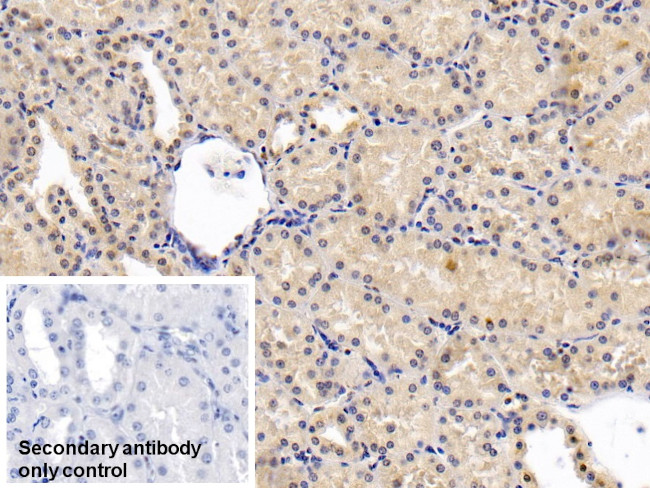 PAI1 Antibody in Immunohistochemistry (Paraffin) (IHC (P))
