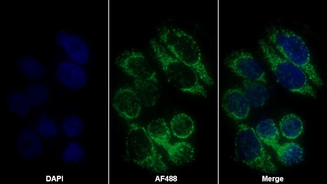 alpha-1 Antitrypsin Antibody in Immunocytochemistry (ICC/IF)