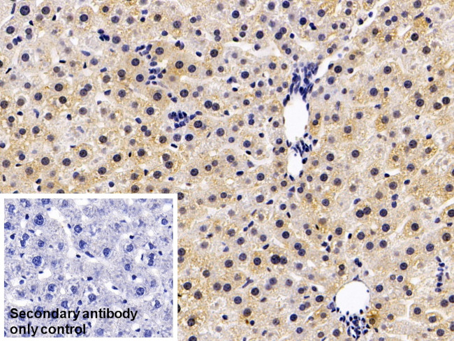 COMT Antibody in Immunohistochemistry (Paraffin) (IHC (P))