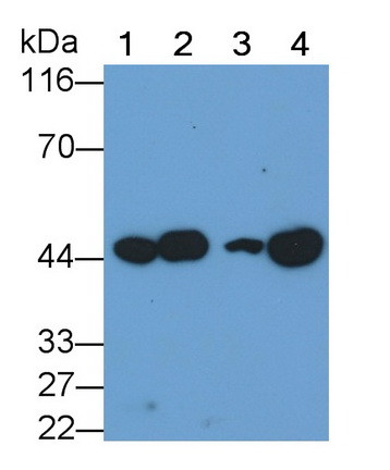 VEGFC Antibody in Western Blot (WB)
