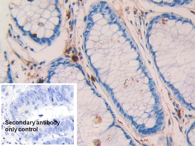 Tryptase Antibody in Immunohistochemistry (Paraffin) (IHC (P))