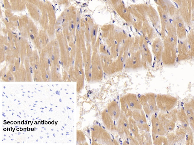 ACVR2A Antibody in Immunohistochemistry (Paraffin) (IHC (P))
