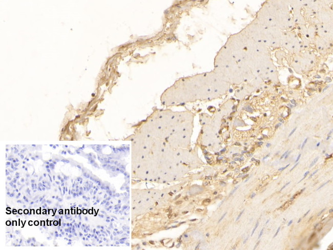 IL-17A Antibody in Immunohistochemistry (Paraffin) (IHC (P))