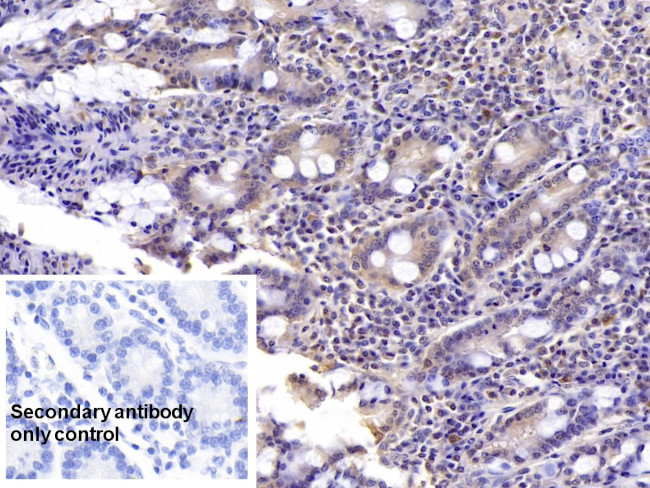 SHH Antibody in Immunohistochemistry (Paraffin) (IHC (P))