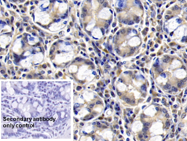 FAP Antibody in Immunohistochemistry (Paraffin) (IHC (P))