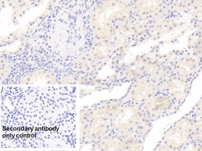 RHD Antibody in Immunohistochemistry (Paraffin) (IHC (P))