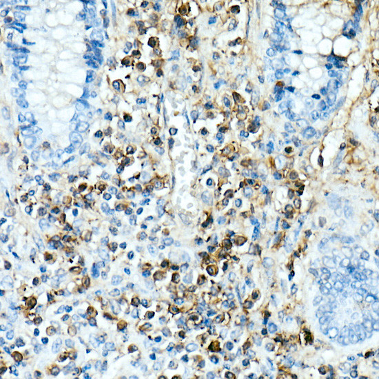 IL-17A Antibody in Immunohistochemistry (Paraffin) (IHC (P))