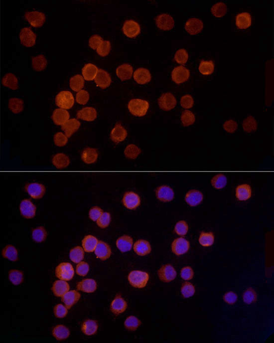 Cathepsin G Antibody in Immunocytochemistry (ICC/IF)