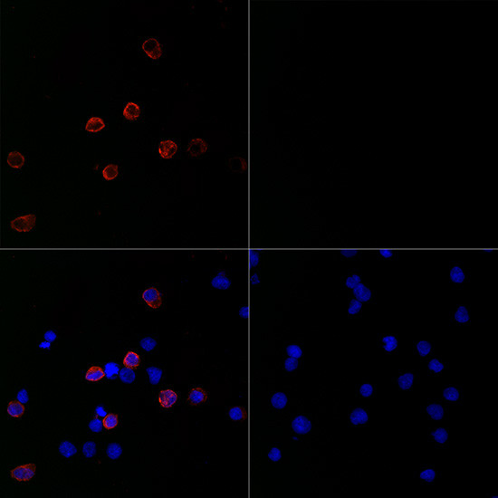 SARS-CoV-2 Spike Protein S1 Antibody in Immunocytochemistry (ICC/IF)