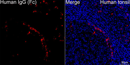 Human IgG (Fc) Antibody in Immunohistochemistry (Paraffin) (IHC (P))