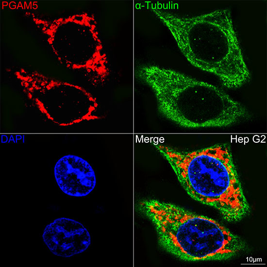 PGAM5 Antibody in Immunocytochemistry (ICC/IF)