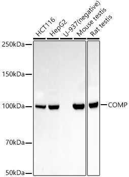 COMP Antibody in Western Blot (WB)