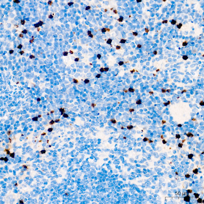 Ly-6G Antibody in Immunohistochemistry (Paraffin) (IHC (P))