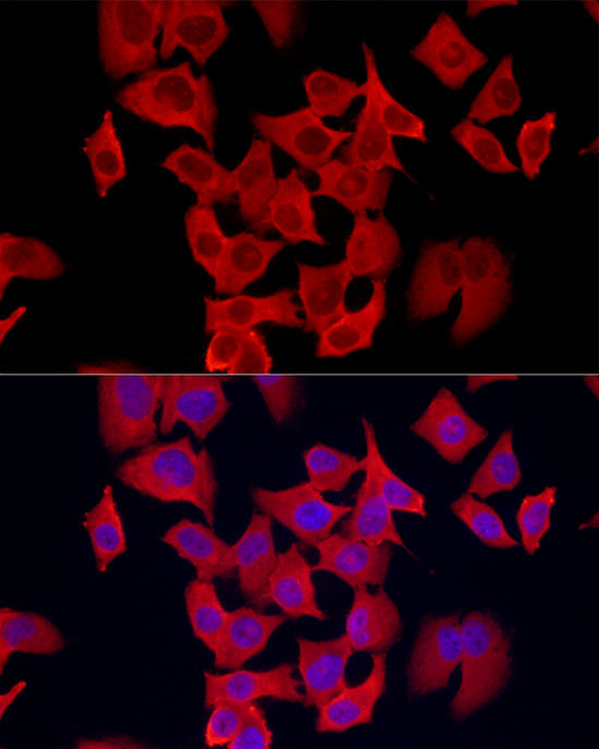 S100A11 Antibody in Immunocytochemistry (ICC/IF)