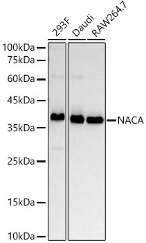 NACA Antibody in Western Blot (WB)